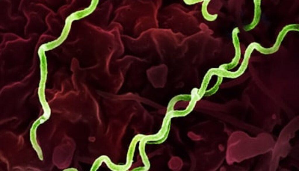 Treponema pallidum Bacteria (Syphilis) Colorized electron micrograph of Treponema pallidum, the bacteria that cause syphilis. Several spiral-shaped...