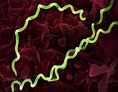Treponema pallidum Bacteria (Syphilis) Colorized electron micrograph of Treponema pallidum, the bacteria that cause syphilis. Several spiral-shaped...